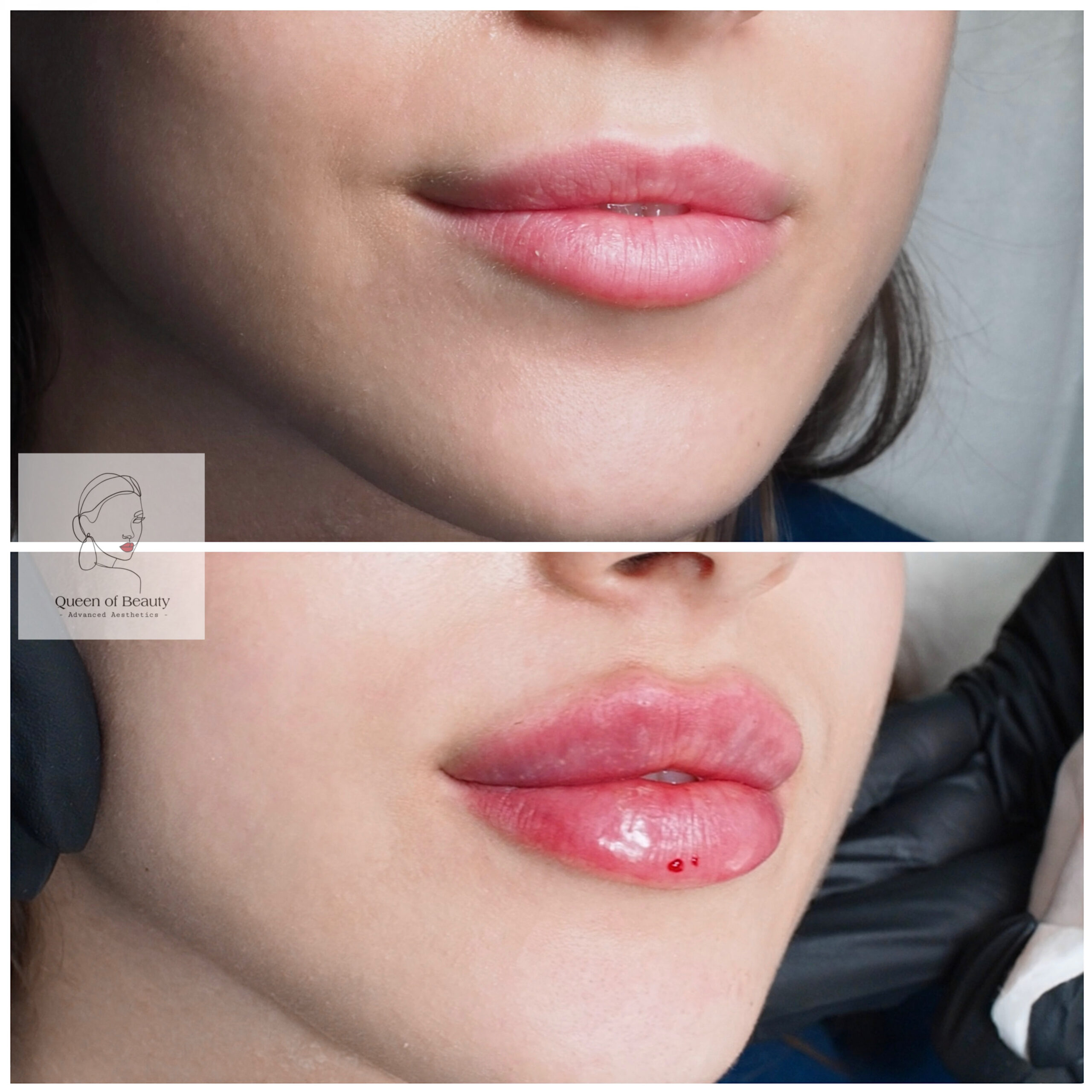 Dubai Lips