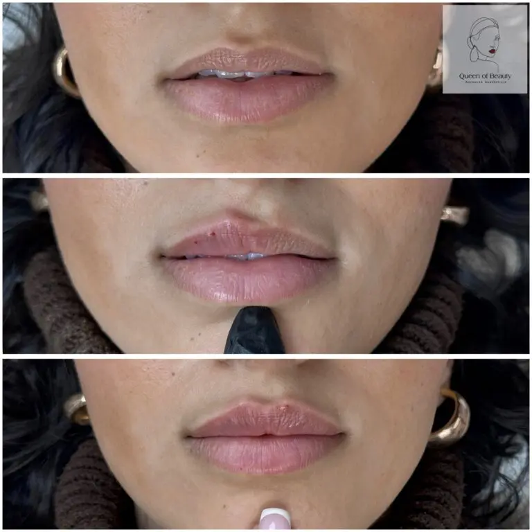 Natural Lips
