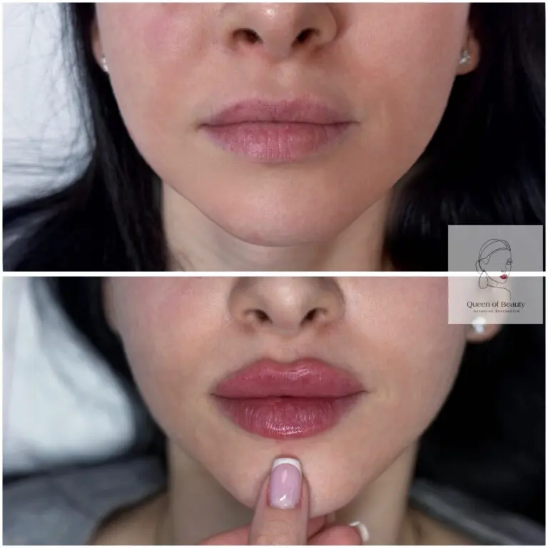 Russian Lips