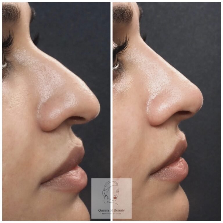 40630ACB-3751-4697-AF36-9643BACA0E51-min