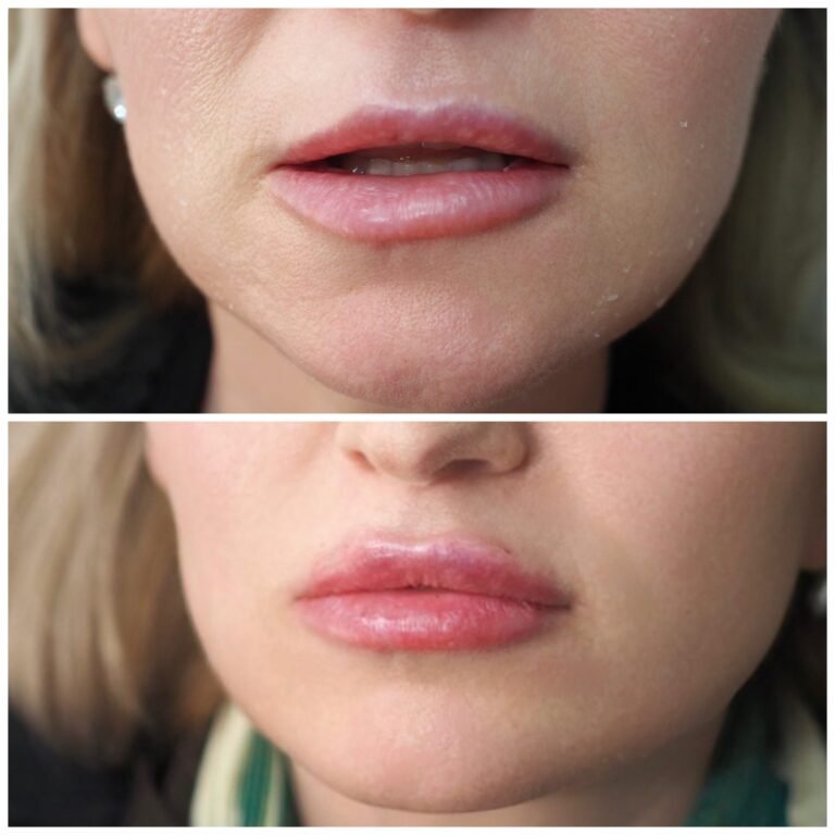 queen-of-beauty-lip-flip-near-me